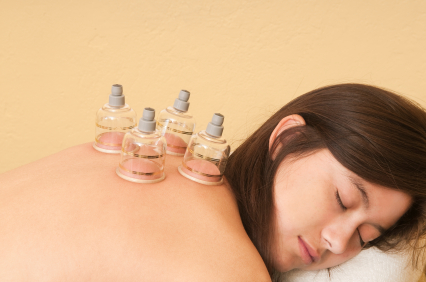 cupping